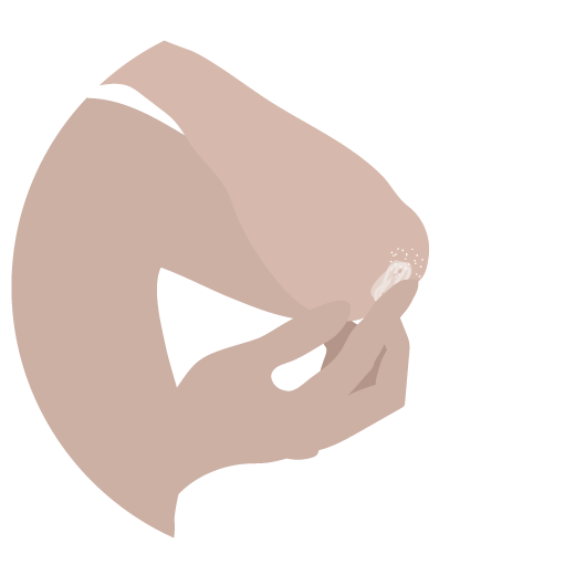 illustration of applying F-Balm™ to the elbow