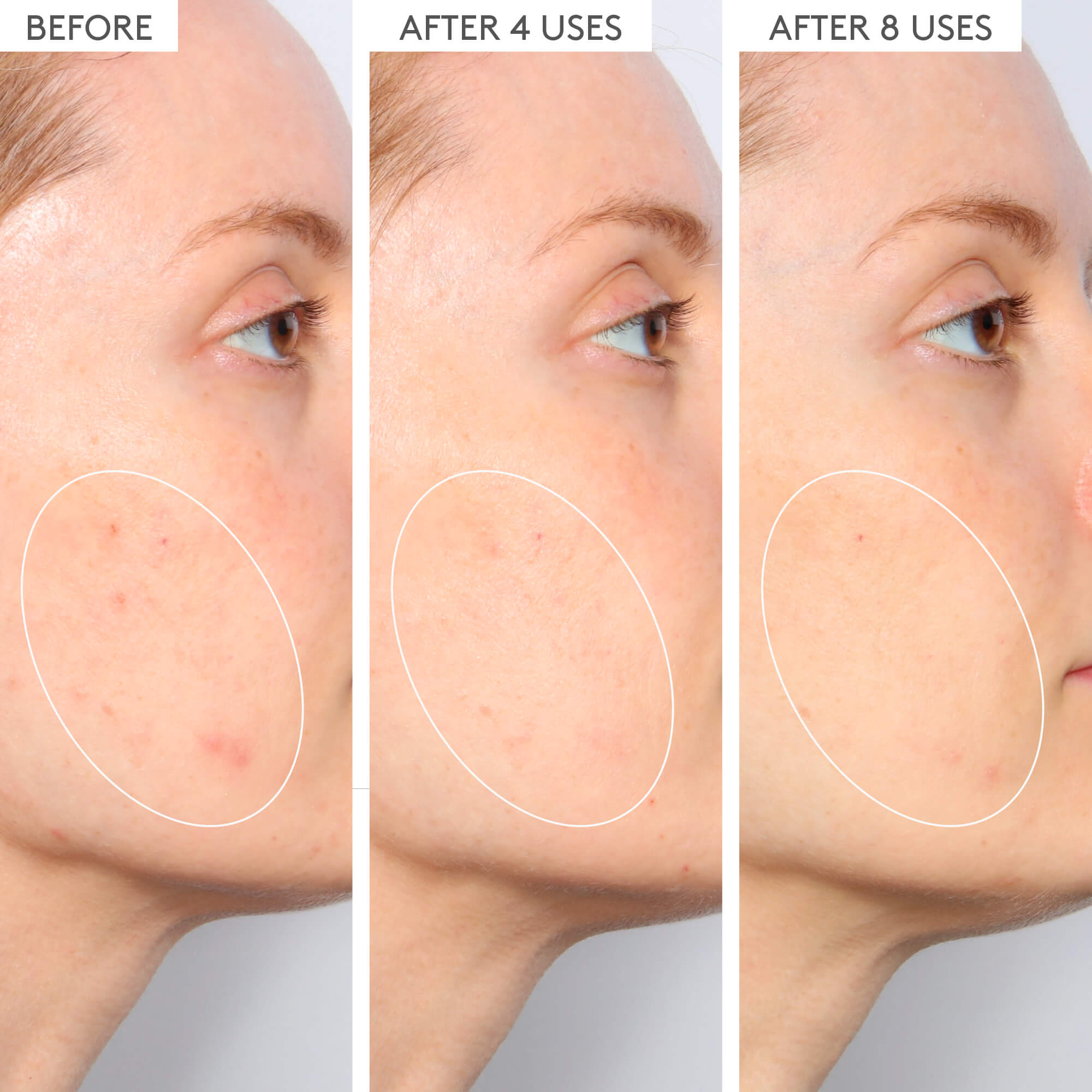 T.L.C. Sukari Babyfacial&trade;, 