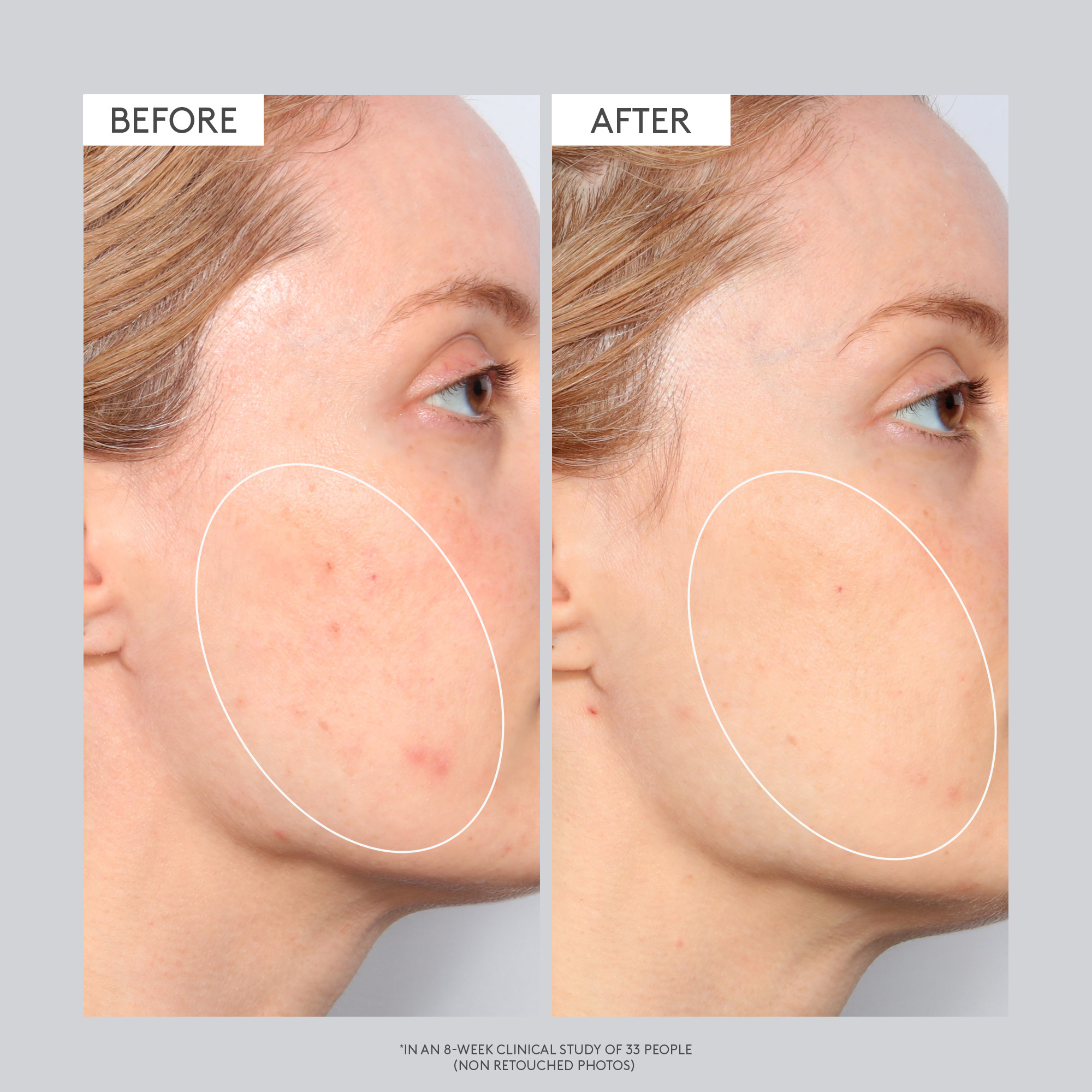 T.L.C. Sukari Babyfacial&trade;, 