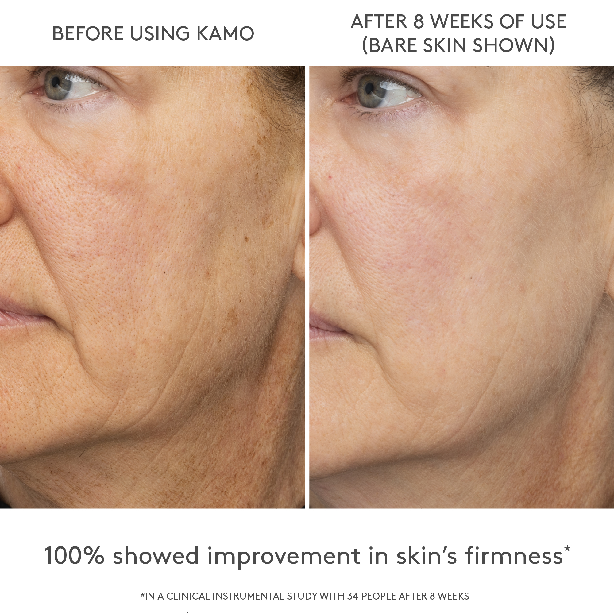 Kamo Triple-Peptide&trade; Cover Drops, Fair 2C